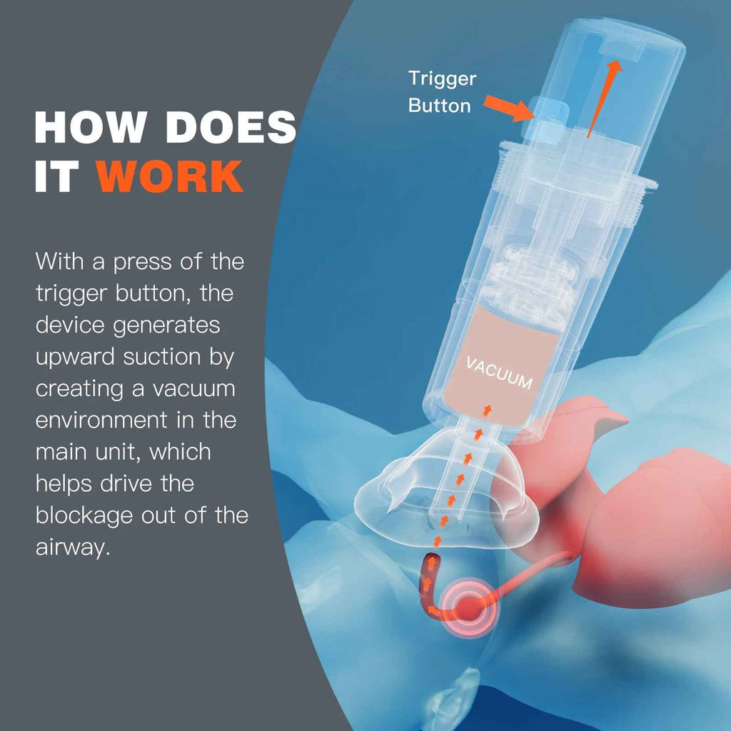 Automatic Choking Rescue Device for Quick Emergency Relief - RFE Marketing Ventures