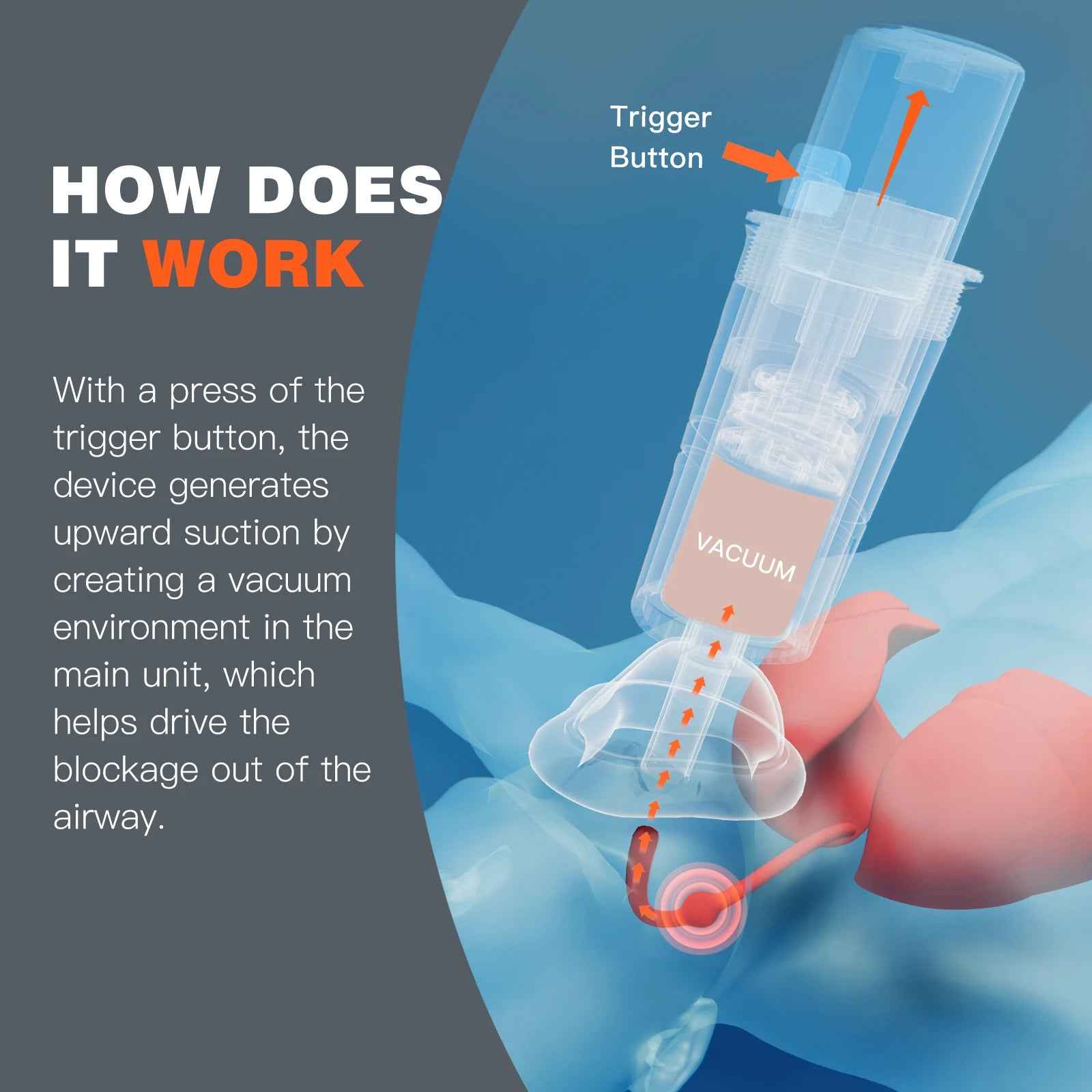 Automatic Choking Rescue Device for Quick Emergency Relief - RFE Marketing Ventures